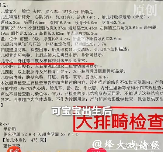 产检正常生出畸形儿!漏诊先天性脊柱畸形,医生调离岗位,副院长立案调查 产检正常生出畸形儿!漏诊先天性脊柱畸形,医生调离岗位,副院长立案调查